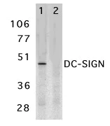 Western blot - Anti-DC-SIGN antibody (AB5716)