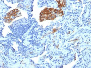 Immunohistochemistry (Formalin/PFA-fixed paraffin-embedded sections) - Anti-DC-SIGN antibody [C209/1781] (AB218419)