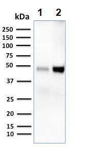 Western blot - Anti-DC-SIGN antibody [C209/1781] (AB218419)