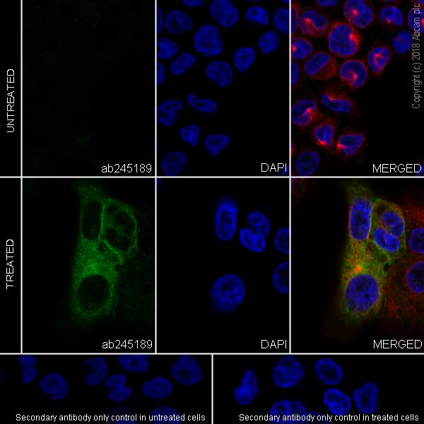 Immunocytochemistry/ Immunofluorescence - Anti-DC-SIGN antibody [EPR22395-52] (AB245189)