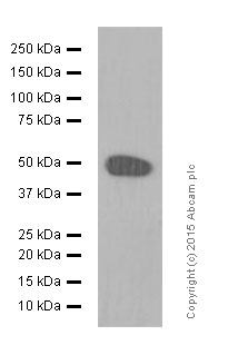 Western blot - Anti-DC-SIGN antibody [EPR5588] (AB124828)