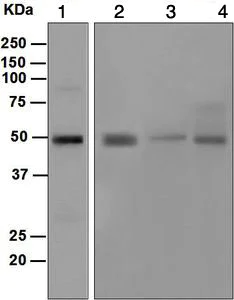 Western blot - Anti-DC-SIGN antibody [EPR5588] - BSA and Azide free (AB210401)