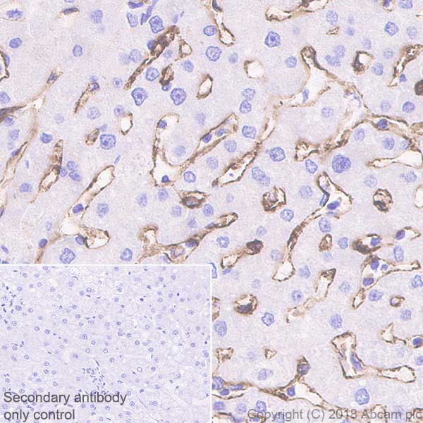 Immunohistochemistry (Formalin/PFA-fixed paraffin-embedded sections) - Anti-DC-SIGN + DC-SIGNR antibody [EPR22395-72] (AB245115)