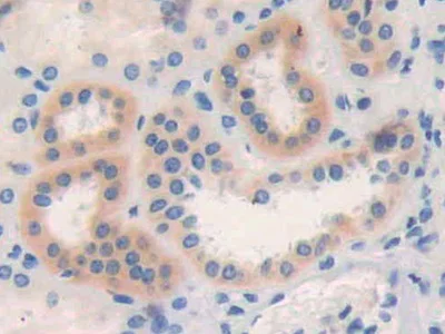 Immunohistochemistry (Formalin/PFA-fixed paraffin-embedded sections) - Anti-DC-SIGNR antibody (AB232709)