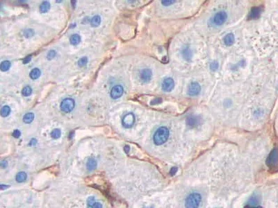 Immunohistochemistry (Formalin/PFA-fixed paraffin-embedded sections) - Anti-DC-SIGNR antibody (AB232709)
