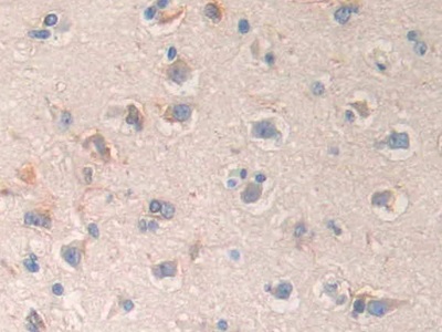 Immunohistochemistry (Formalin/PFA-fixed paraffin-embedded sections) - Anti-DC-SIGNR antibody (AB232709)