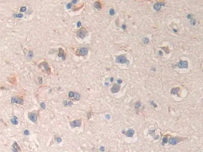 Immunohistochemistry (Formalin/PFA-fixed paraffin-embedded sections) - Anti-DC-SIGNR antibody (AB232709)