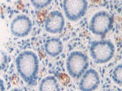Immunohistochemistry (Formalin/PFA-fixed paraffin-embedded sections) - Anti-DC-SIGNR antibody (AB232709)