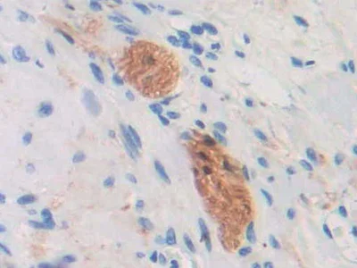 Immunohistochemistry (Formalin/PFA-fixed paraffin-embedded sections) - Anti-DC-SIGNR antibody (AB232709)