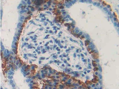 Immunohistochemistry (Formalin/PFA-fixed paraffin-embedded sections) - Anti-DC-SIGNR antibody (AB232709)