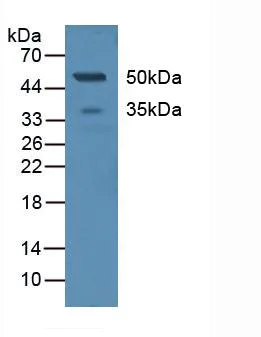 Western blot - Anti-DC-SIGNR antibody (AB232709)