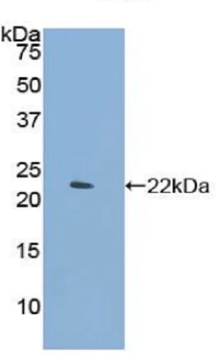 Western blot - Anti-DC-SIGNR antibody (AB232709)