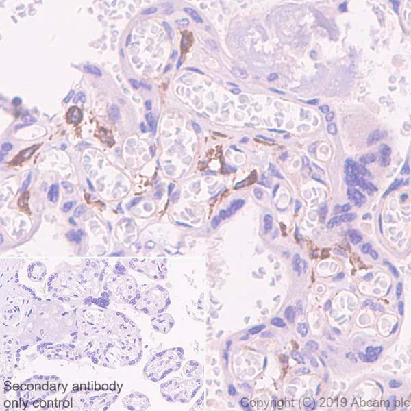 Immunohistochemistry (Formalin/PFA-fixed paraffin-embedded sections) - Anti-DC-SIGNR antibody [EPR11211] - BSA and Azide free (AB240156)