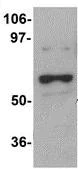 Western blot - Anti-DCAF12 antibody (AB106707)