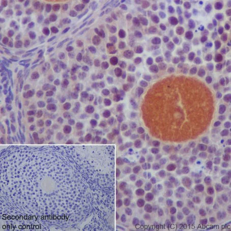 Immunohistochemistry (Formalin/PFA-fixed paraffin-embedded sections) - Anti-DCAF13 antibody [EPR18723] (AB195121)
