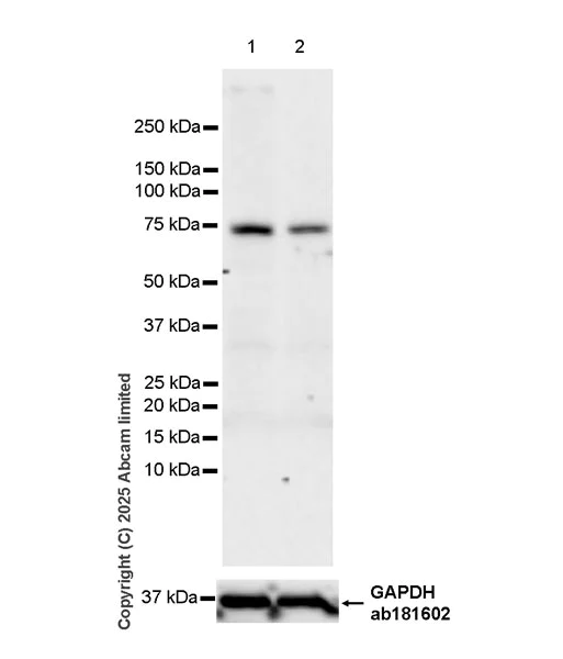 Western blot - Anti-DCAF15 antibody [EPR29653-542] (AB324489)