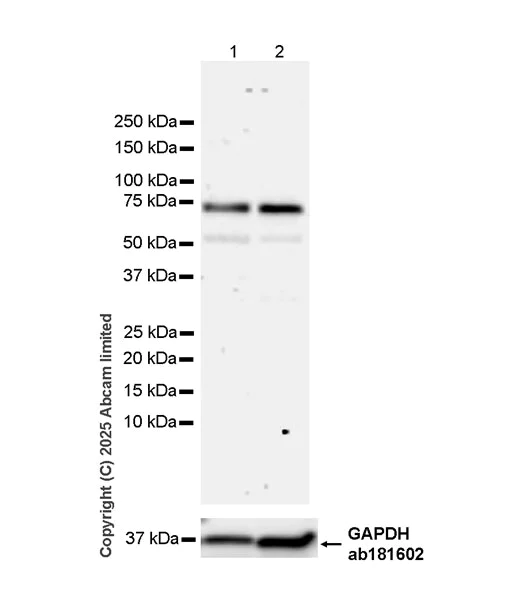 Western blot - Anti-DCAF15 antibody [EPR29653-542] (AB324489)