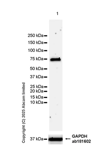 Western blot - Anti-DCAF15 antibody [EPR29653-542] (AB324489)