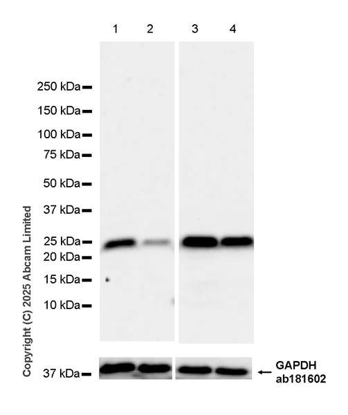 Western blot - Anti-DCAF16 antibody [EPR29654-553] (AB324164)