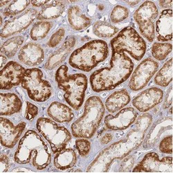 Immunohistochemistry (Formalin/PFA-fixed paraffin-embedded sections) - Anti-DCAF8L1 antibody (AB126359)