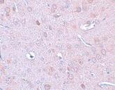 Immunohistochemistry (Formalin/PFA-fixed paraffin-embedded sections) - Anti-DCAMKL1 antibody (AB106635)