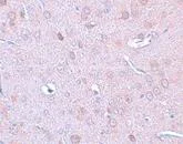 Immunohistochemistry (Formalin/PFA-fixed paraffin-embedded sections) - Anti-DCAMKL1 antibody (AB106635)