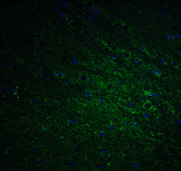 Immunohistochemistry (Formalin/PFA-fixed paraffin-embedded sections) - Anti-DCAMKL1 antibody (AB106635)
