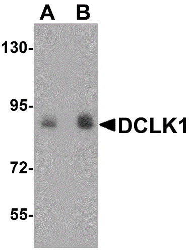 Western blot - Anti-DCAMKL1 antibody (AB106635)