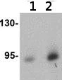 Western blot - Anti-DCAMKL1 antibody (AB106635)