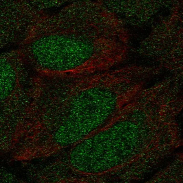 Immunocytochemistry/ Immunofluorescence - Anti-DCAMKL1 antibody (AB262845)