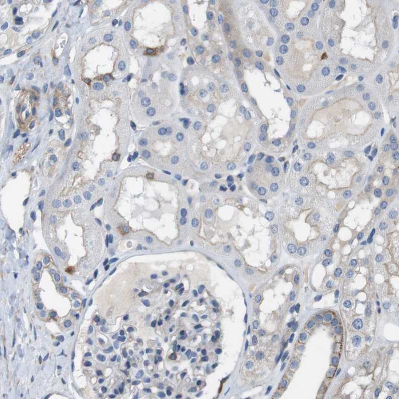 Immunohistochemistry (Formalin/PFA-fixed paraffin-embedded sections) - Anti-DCAMKL1 antibody (AB262846)
