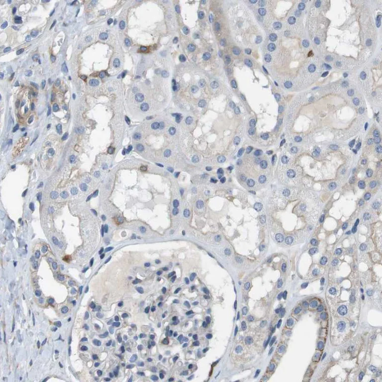 Immunohistochemistry (Formalin/PFA-fixed paraffin-embedded sections) - Anti-DCAMKL1 antibody (AB262846)