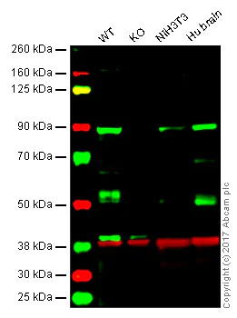 Western blot - Anti-DCAMKL1 antibody (AB31704)