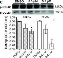 Western blot - Anti-DCAMKL1 antibody (AB31704)
