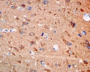 Immunohistochemistry (Formalin/PFA-fixed paraffin-embedded sections) - Anti-DCAMKL1 antibody [EPR6085] - BSA and Azide free (AB187184)