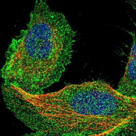 Immunocytochemistry/ Immunofluorescence - Anti-DCBLD2/ESDN antibody (AB224102)