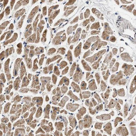 Immunohistochemistry (Formalin/PFA-fixed paraffin-embedded sections) - Anti-DCBLD2/ESDN antibody (AB224102)