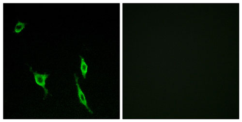 Immunocytochemistry/ Immunofluorescence - Anti-DCC antibody (AB196598)