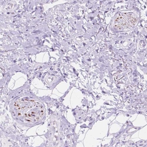 Immunohistochemistry (Formalin/PFA-fixed paraffin-embedded sections) - Anti-DCC antibody (AB244540), expandable thumbnail