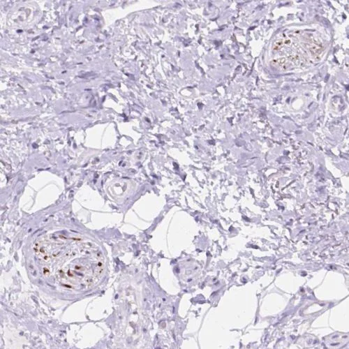 Immunohistochemistry (Formalin/PFA-fixed paraffin-embedded sections) - Anti-DCC antibody (AB244540)