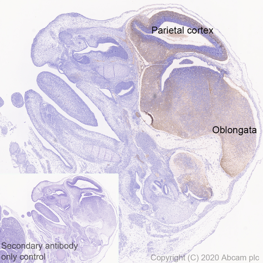 Immunohistochemistry (Formalin/PFA-fixed paraffin-embedded sections) - Anti-DCC antibody [EPR23313-115] (AB273570), expandable thumbnail