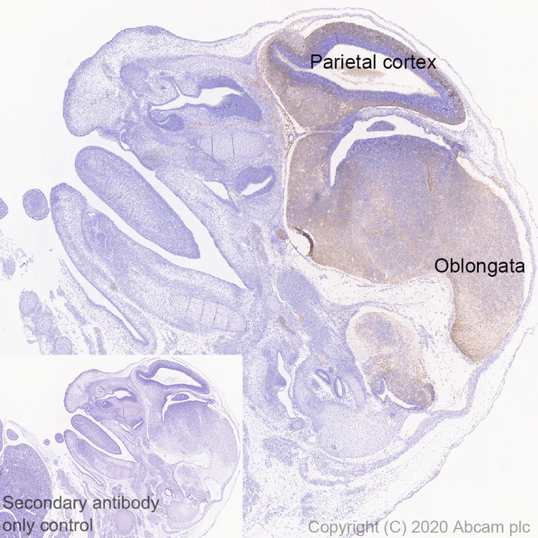 Immunohistochemistry (Formalin/PFA-fixed paraffin-embedded sections) - Anti-DCC antibody [EPR23313-115] (AB273570)