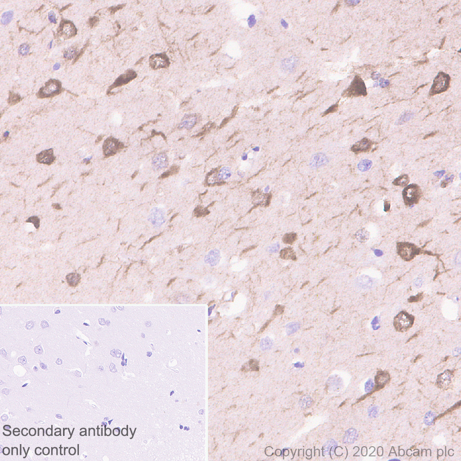 Immunohistochemistry (Formalin/PFA-fixed paraffin-embedded sections) - Anti-DCC antibody [EPR23313-115] (ab273570), expandable thumbnail