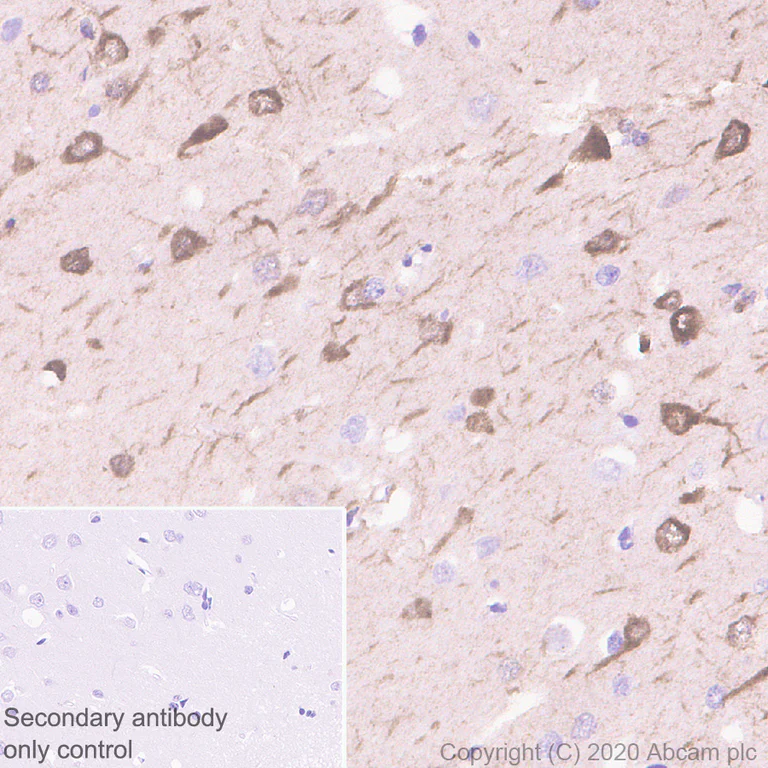 Immunohistochemistry (Formalin/PFA-fixed paraffin-embedded sections) - Anti-DCC antibody [EPR23313-115] (AB273570)