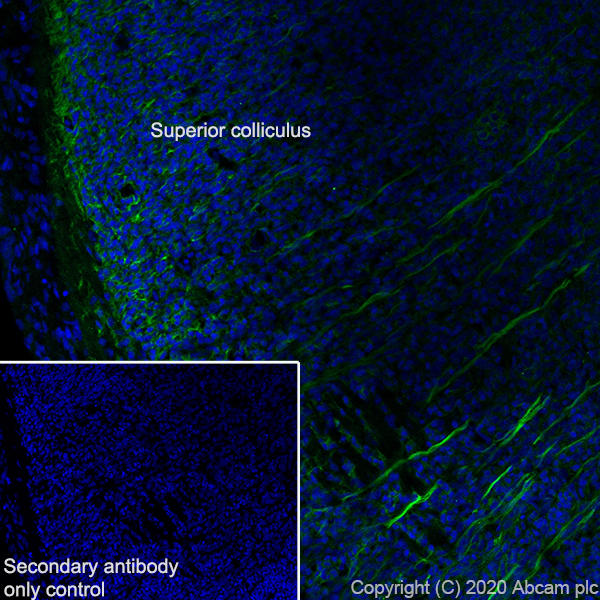 Immunohistochemistry (Frozen sections) - Anti-DCC antibody [EPR23313-115] (ab273570), expandable thumbnail