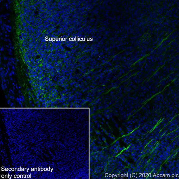 Immunohistochemistry (Frozen sections) - Anti-DCC antibody [EPR23313-115] (AB273570)