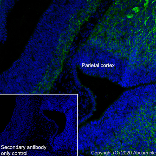 Immunohistochemistry (Frozen sections) - Anti-DCC antibody [EPR23313-115] (ab273570), expandable thumbnail