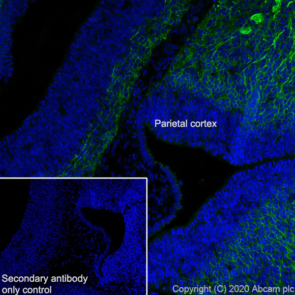 Immunohistochemistry (Frozen sections) - Anti-DCC antibody [EPR23313-115] (AB273570)