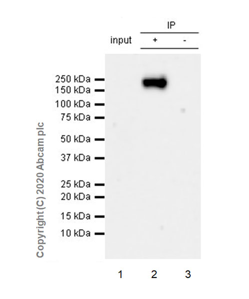 Immunoprecipitation - Anti-DCC antibody [EPR23313-115] (AB273570), expandable thumbnail