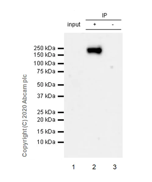 Immunoprecipitation - Anti-DCC antibody [EPR23313-115] (AB273570)